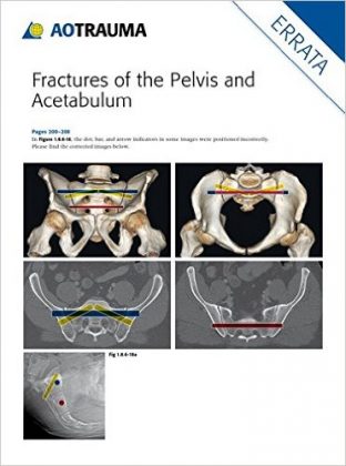 acetabulum of pelvis