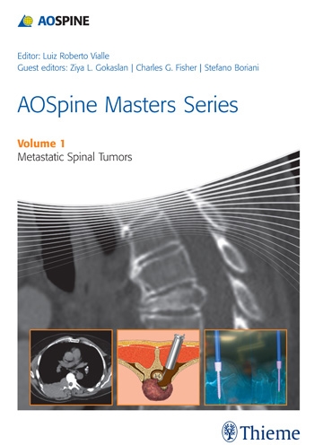 aospine-masters-series-volume-1-metastatic-spinal-tumors