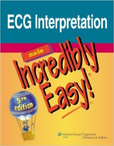 ecg-interpretation-made-incredibly-easy