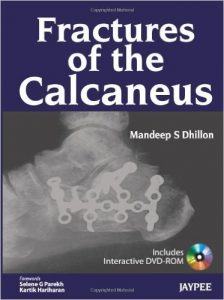 fractures-of-the-calcaneus-1st-edition