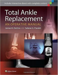 total-ankle-replacement-an-operative-manual-first-edition