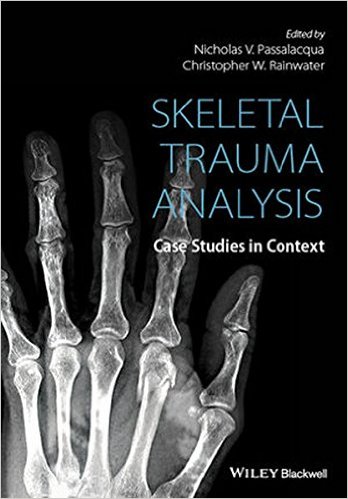 Skeletal-Trauma-Analysis