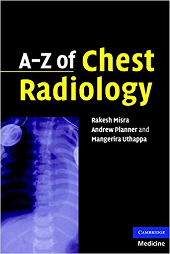 A-Z of Chest Radiology 1st Edition