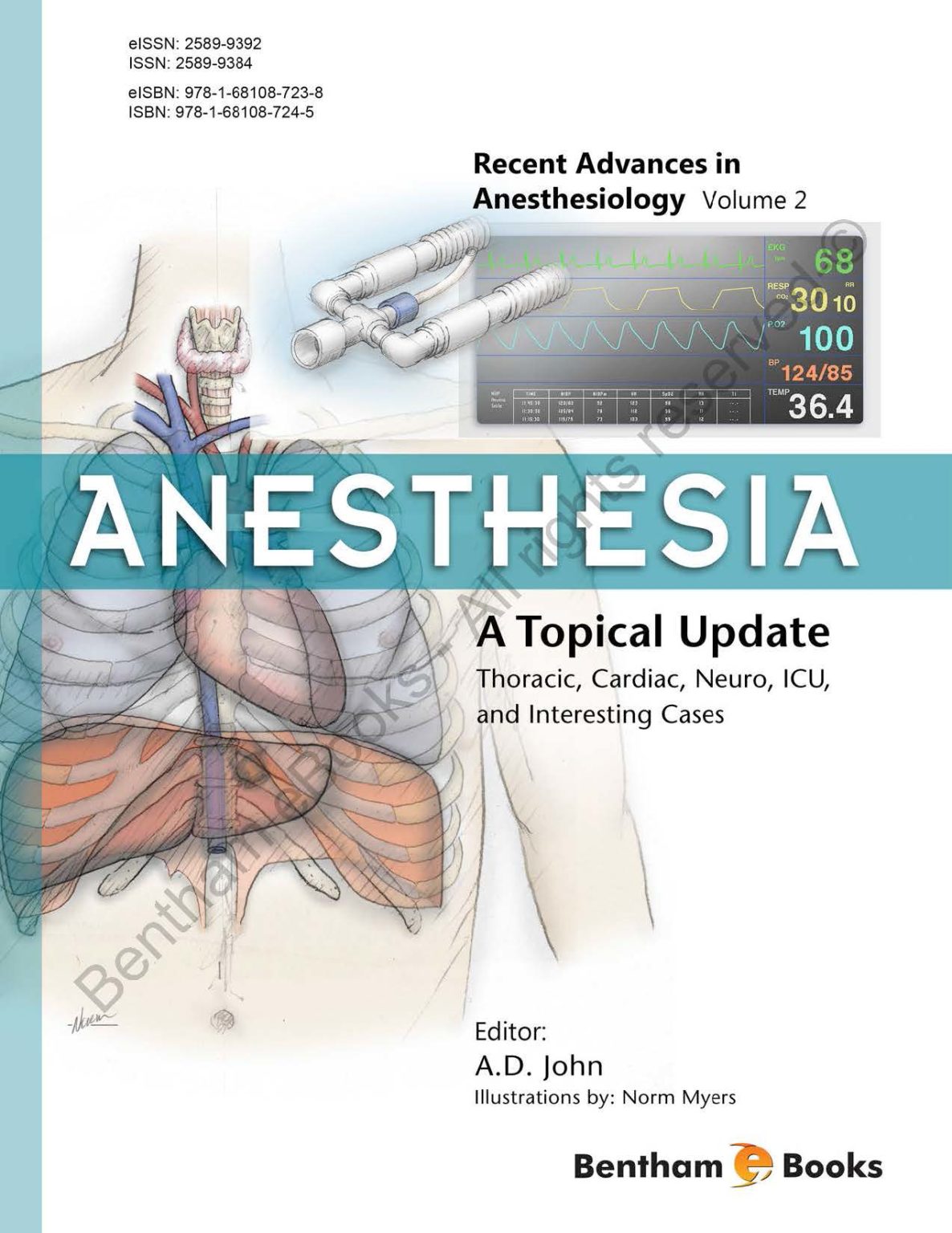 Anesthesia: A Topical Update – Thoracic, Cardiac, Neuro, ICU, And ...