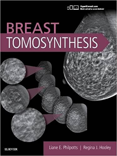 Breast Tomosynthesis 1st Edition
