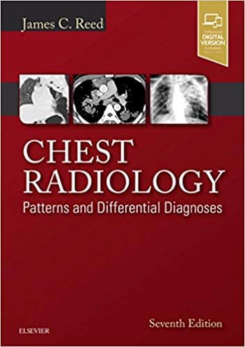 Chest Radiology: Patterns and Differential Diagnoses 7th Edition
