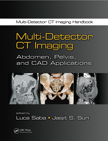Multi-Detector CT Imaging: Abdomen, Pelvis, and CAD Applications 1st Edition
