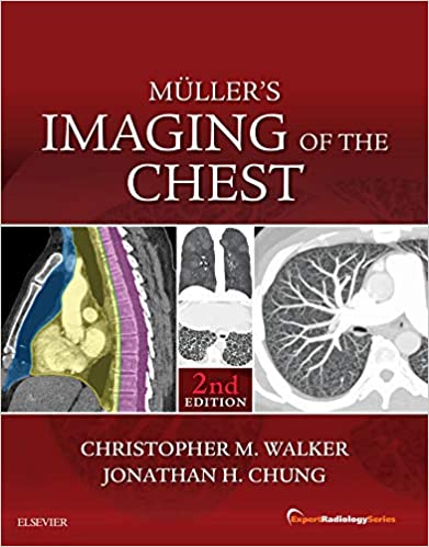 Muller's Imaging of the Chest 2nd Edition